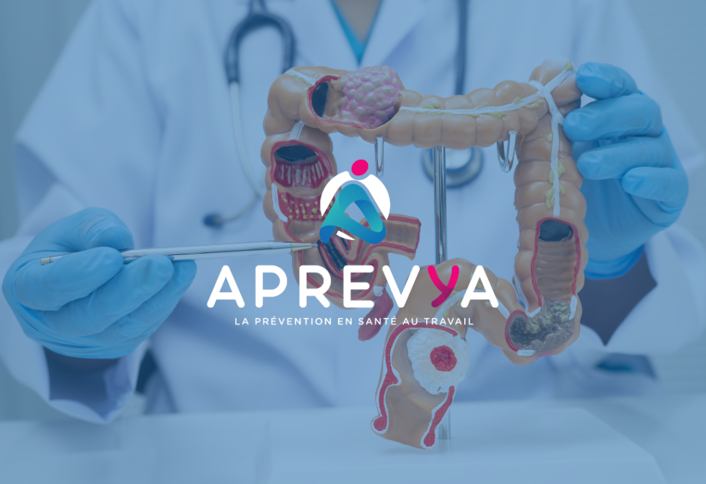 Modèle anatomique du côlon tenu par un professionnel de santé, illustration du dépistage du cancer colorectal – Mars Bleu - Aprevya prévention en santé au travail
